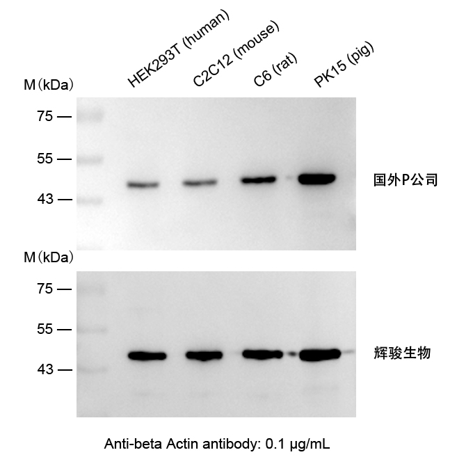 β-Actin小鼠單克隆抗體使用案例-抗體操作簡單,快速制備Actin抗體-輝駿生物